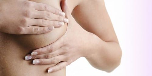 Έκκριμα θηλής